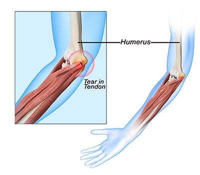 Elbow Anatomy