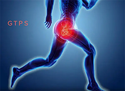 Greater Trochanter Pain Syndrome