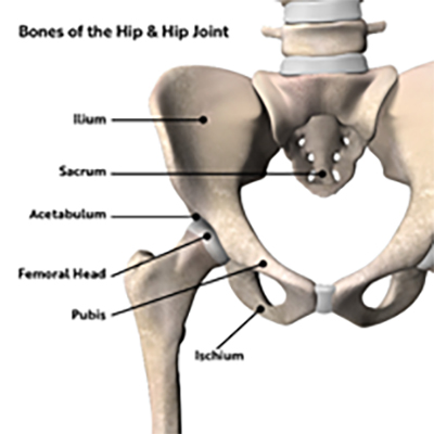 Ischiofemoral Impingement