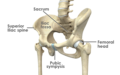 Hip Alignment Abnormalities - 2 - Educational Photo