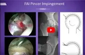 Dr. Sanjeev Bhatia of Northwestern Medicine presents as Guest Faculty at AHI logo