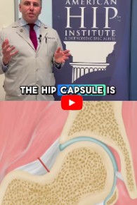 What is the hip capsule? Video