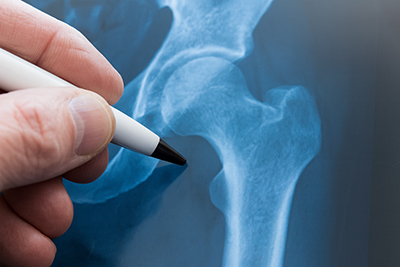 Abigail Roberts, PA-C, MPAS