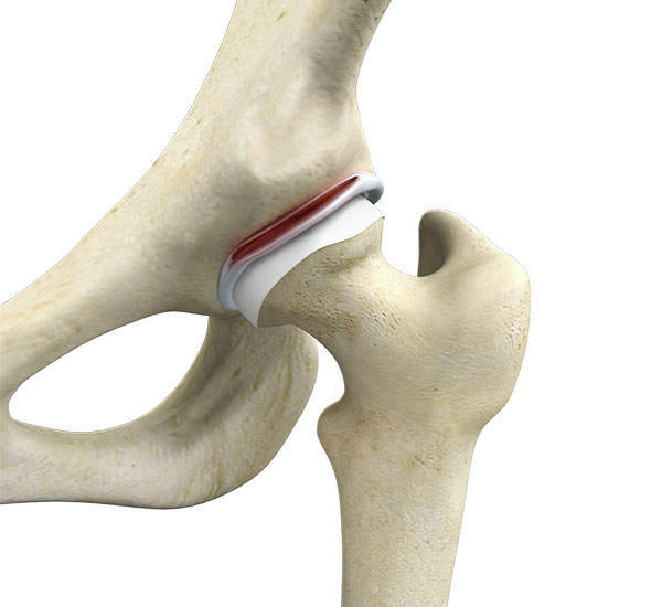 Understanding the Anatomy of the Hip Joint