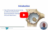 AANA Conference: Labral Reconstruction Shows Favorable Outcomes in Adolescents and Young Adults