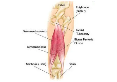 Proximal Hamstring Tear logo