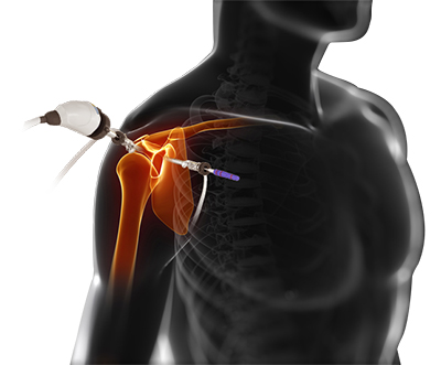 Shoulder Anatomy