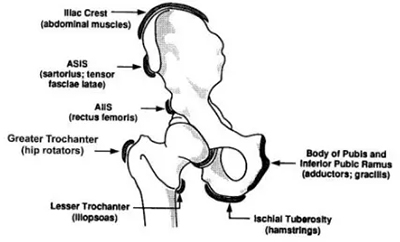 Subspine Impingement
