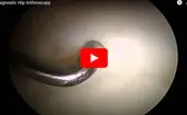 Diagnostic Hip Arthroscopy logo