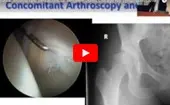 Dysplasia: Arthroscopic Indications, Dr. Benjamin Domb, Chicago Hip Symposium (2013) logo