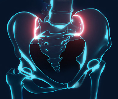 What is the Sacroiliac Joint?