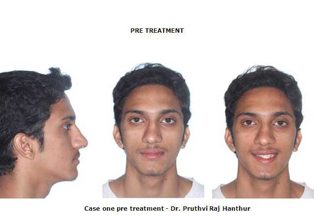 Orthodontics image1