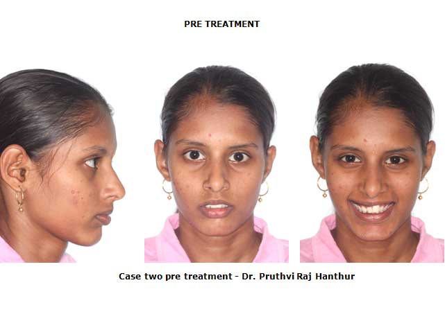 Orthodontics image2