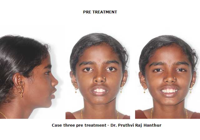 Orthodontics image3
