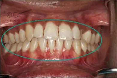 Periodontics After Treatment