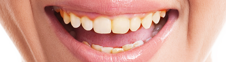 Success Stories Before & After Treatment