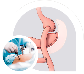 Revisional Surgery img