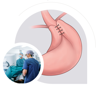 Corrective Surgery img