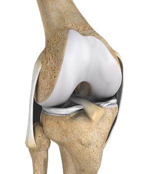 Multiligament Instability