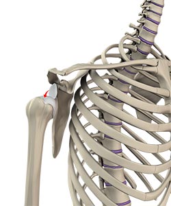 Shoulder Dislocation