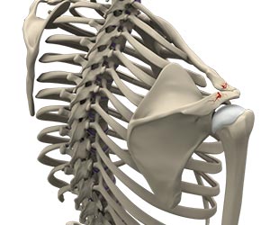 Shoulder Fracture