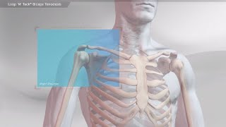 Loop 'N' Tack<sup>™</sup> Biceps Tenodesis Videos