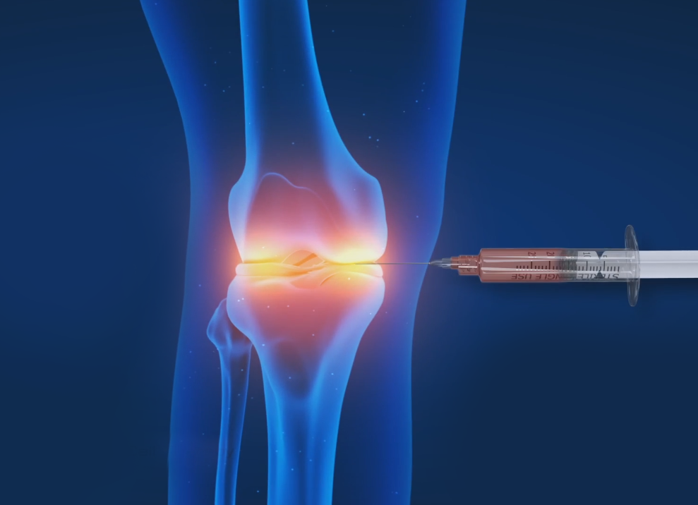 BMAC Knee Conditions