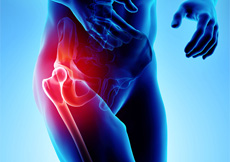 Picture of Hip Pain