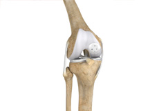 Picture of Knee Cartilage Restoration