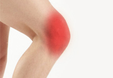 Picture of Knee Pain