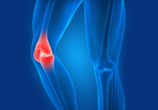 Picture of Knee Sports Injuries