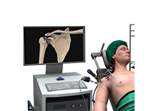 Picture of Minimally Invasive Shoulder Joint Replacement
