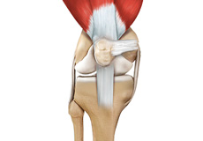 Picture of Quadriceps Tendon Repair