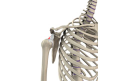 Picture of Shoulder Instability / Shoulder Dislocation