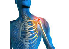 Picture of Shoulder Pain