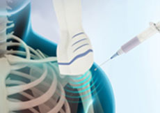 Picture of Ultrasound-Guided Shoulder Injections