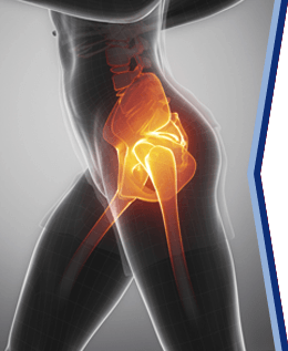 Hip joint orthopedic conditions