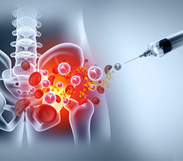 Biologic Injections and Healing Potential: What Current Evidence Actually Suggests