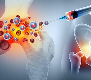 Labral Tears