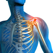 Shoulder Pain