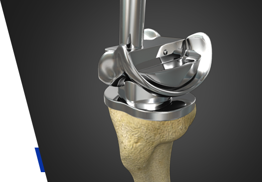 Chris Hoedt, MD - Orthopaedic Surgeon - Hip & Knee Reconstruction Specialist