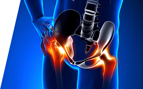 Chris Hoedt, MD - Orthopaedic Surgeon - Hip & Knee Reconstruction Specialist
