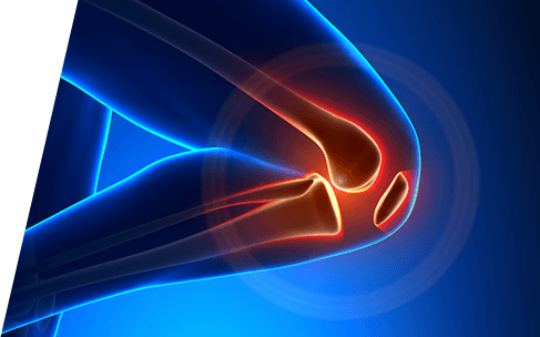 Chris Hoedt, MD - Orthopaedic Surgeon - Hip & Knee Reconstruction Specialist