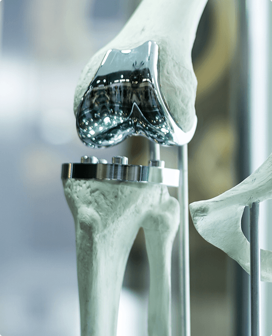 Anatomical joint model used to explain advanced joint replacement