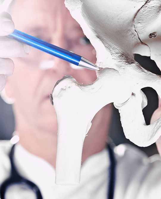Anatomical hip joint model used to explain hip replacement