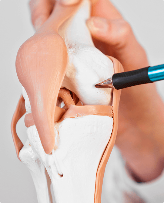 Anatomical knee joint model used to explain knee replacement