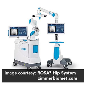 Picture of Robotic Total Hip Replacement