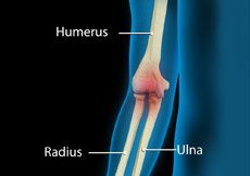 Elbow Pain