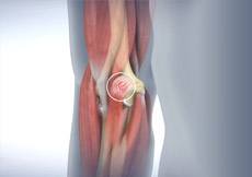 Golfer's Elbow Surgery