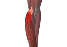 Golfer's Elbow